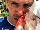 Французского велогонщика избили бейсбольной битой во время тренировки